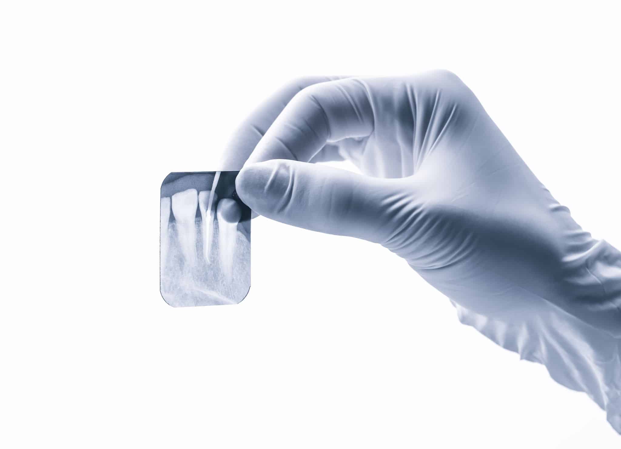 Dental X-Rays Dental Photography Product- Dentaplus Dental Supplies Australia